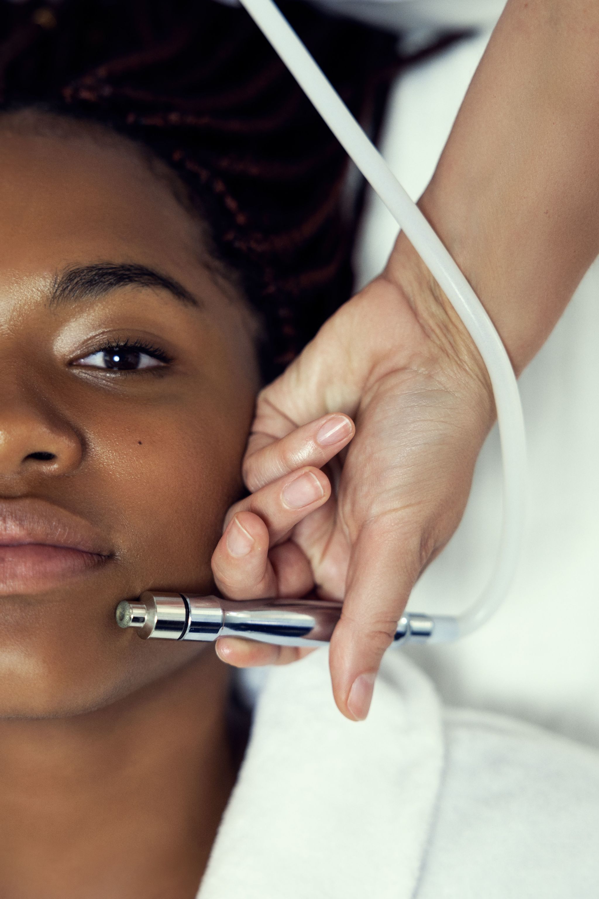 MICRONEEDLING INTENSIVE MIT RADIOFREQUENZ – 3 Sessions